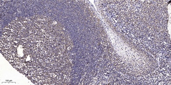 Fra-1 antibody