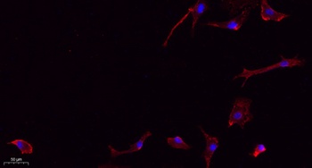 Frizzled-7 rabbit pAb