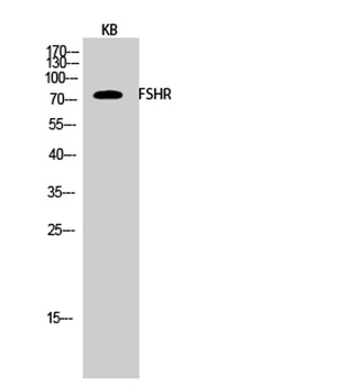 FSHR antibody