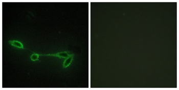 Fucokinase antibody