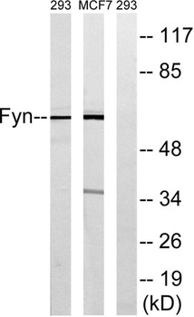 Fyn antibody