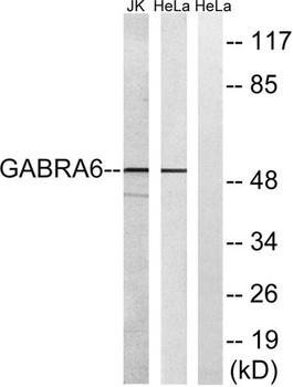 GABAA R alpha 6 antibody