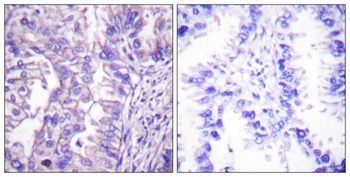 GAD-65/67 antibody