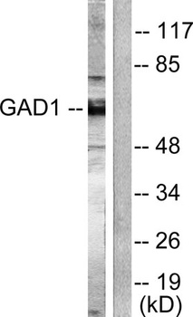 GAD-65/67 antibody