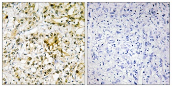 Galectin-4 rabbit pAb
