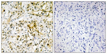 Galectin-4 antibody