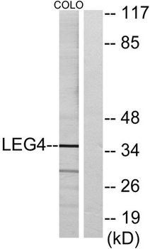 Galectin-4 rabbit pAb