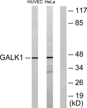 GALK1 rabbit pAb