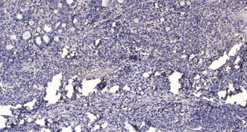 GALK1 antibody