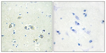 Gas6 antibody