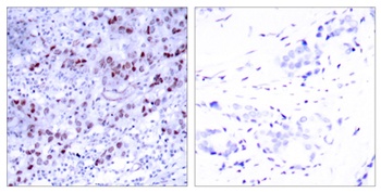 GATA-1 rabbit pAb Antibody
