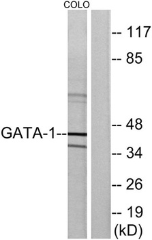 GATA-1 rabbit pAb Antibody