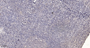 GBDR1 antibody