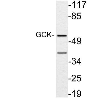 GCK antibody