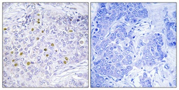 GCN5 antibody