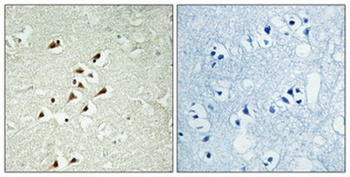 GCP5 rabbit pAb