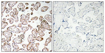 GCSm-gamma antibody