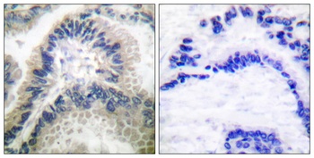 GCS-β-1 rabbit pAb