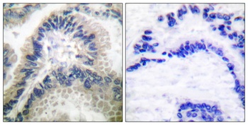 GCS-beta-1 antibody