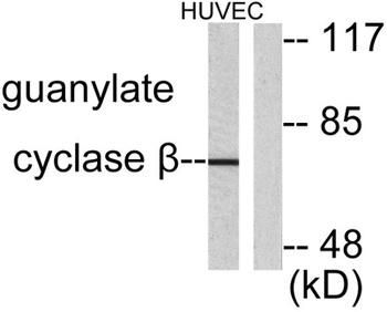 GCS-β-1 rabbit pAb