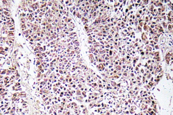 GDF-9 antibody