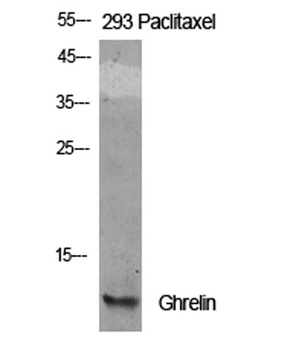 Ghrelin antibody