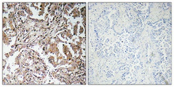 Ghrelin antibody