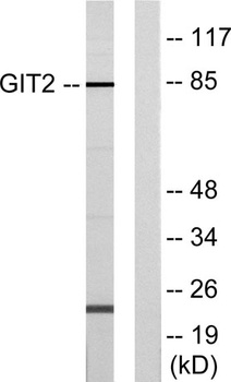 GIT2 rabbit pAb