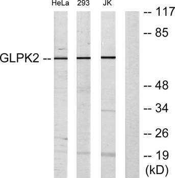 GK2 rabbit pAb