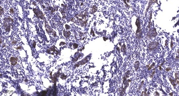 GK2 antibody