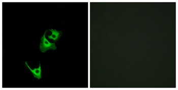 GLP-1 antibody