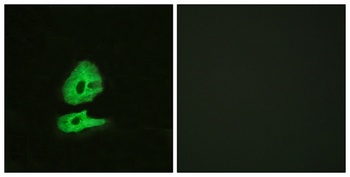 Glucagon Receptor rabbit pAb