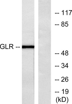 Glucagon Receptor rabbit pAb