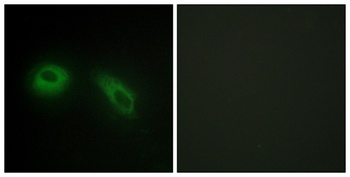 Glucosidase II beta antibody