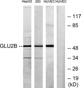 Glucosidase II beta antibody