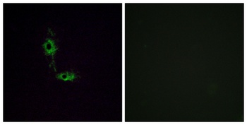 GluR-1 rabbit pAb