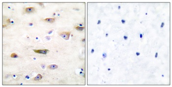 GluR-2 antibody