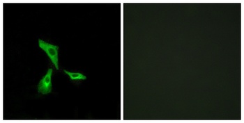 GPR101 antibody