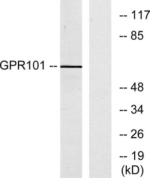 GPR101 rabbit pAb