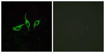 GPR120 antibody