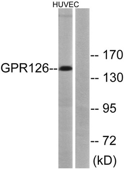GPR126 rabbit pAb