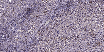 GPR126 antibody