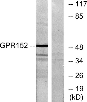 GPR152 rabbit pAb