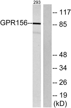 GPR156 rabbit pAb