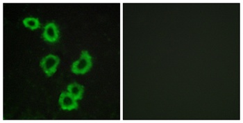 GPR176 antibody