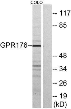 GPR176 rabbit pAb