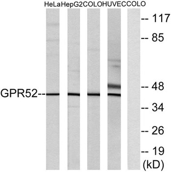 GPR52 rabbit pAb