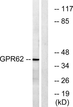 GPR62 rabbit pAb Antibody