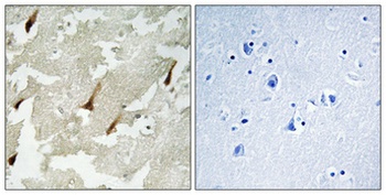 GRIN2 antibody