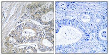 GRIN2 antibody